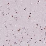 BRD4 Antibody in Immunohistochemistry (Paraffin) (IHC (P))