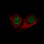 BRD4 Monoclonal Antibody (CL1118)