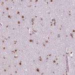 BRD4 Antibody in Immunohistochemistry (Paraffin) (IHC (P))