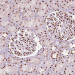 BRD4 Antibody in Immunohistochemistry (Paraffin) (IHC (P))