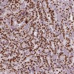BRD4 Antibody in Immunohistochemistry (Paraffin) (IHC (P))