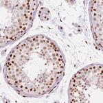 BRD4 Antibody in Immunohistochemistry (Paraffin) (IHC (P))