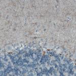 c-Kit Antibody in Immunohistochemistry (Paraffin) (IHC (P))