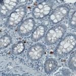 c-Kit Antibody in Immunohistochemistry (Paraffin) (IHC (P))