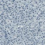 c-Kit Antibody in Immunohistochemistry (Paraffin) (IHC (P))