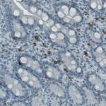 c-Kit Antibody in Immunohistochemistry (Paraffin) (IHC (P))