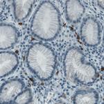 c-Kit Antibody in Immunohistochemistry (Paraffin) (IHC (P))