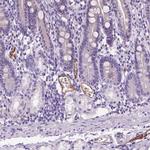 VWF Antibody in Immunohistochemistry (Paraffin) (IHC (P))