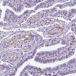 VWF Antibody in Immunohistochemistry (Paraffin) (IHC (P))