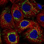 TUFM Monoclonal Antibody (CL2245)