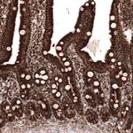 TUFM Antibody in Immunohistochemistry (Paraffin) (IHC (P))