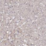 Citrate Synthase Antibody in Immunohistochemistry (Paraffin) (IHC (P))