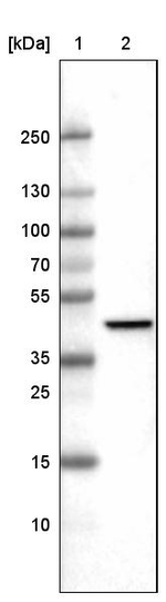 Citrate Synthase Antibody in Western Blot (WB)