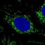 Citrate Synthase Antibody in Immunocytochemistry (ICC/IF)