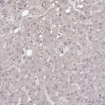 Citrate Synthase Antibody in Immunohistochemistry (Paraffin) (IHC (P))