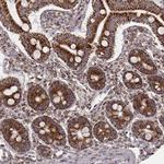 Citrate Synthase Antibody in Immunohistochemistry (Paraffin) (IHC (P))