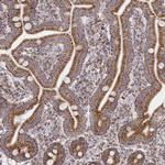 Citrate Synthase Antibody in Immunohistochemistry (Paraffin) (IHC (P))