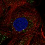 ACAA1 Monoclonal Antibody (CL2663)