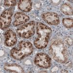 ACAA1 Antibody in Immunohistochemistry (Paraffin) (IHC (P))