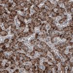 ACAA1 Antibody in Immunohistochemistry (Paraffin) (IHC (P))