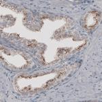 ACAA1 Antibody in Immunohistochemistry (Paraffin) (IHC (P))