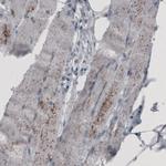 ACAA1 Antibody in Immunohistochemistry (Paraffin) (IHC (P))
