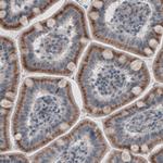 ACAA1 Antibody in Immunohistochemistry (Paraffin) (IHC (P))