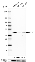 ACAA1 Antibody in Western Blot (WB)