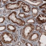 ACAA1 Antibody in Immunohistochemistry (Paraffin) (IHC (P))