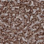 ACAA1 Antibody in Immunohistochemistry (Paraffin) (IHC (P))