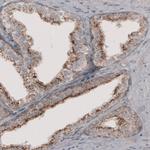 ACAA1 Antibody in Immunohistochemistry (Paraffin) (IHC (P))