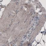 ACAA1 Antibody in Immunohistochemistry (Paraffin) (IHC (P))