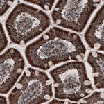 ACAA1 Antibody in Immunohistochemistry (Paraffin) (IHC (P))