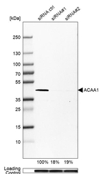 ACAA1 Antibody in Western Blot (WB)