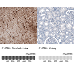 S100B Antibody in Immunohistochemistry (Paraffin) (IHC (P))