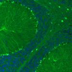 S100B Antibody in Immunohistochemistry (Paraffin) (IHC (P))