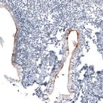 CA125 Antibody in Immunohistochemistry (Paraffin) (IHC (P))
