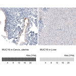 CA125 Antibody in Immunohistochemistry (Paraffin) (IHC (P))