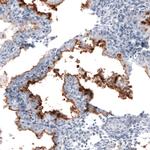 CA125 Antibody in Immunohistochemistry (Paraffin) (IHC (P))