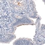 CA125 Antibody in Immunohistochemistry (Paraffin) (IHC (P))