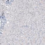 CA125 Antibody in Immunohistochemistry (Paraffin) (IHC (P))