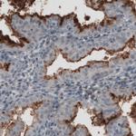 CA125 Monoclonal Antibody (CL2783)