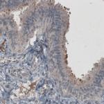 CA125 Antibody in Immunohistochemistry (Paraffin) (IHC (P))