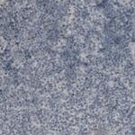 CA125 Antibody in Immunohistochemistry (Paraffin) (IHC (P))