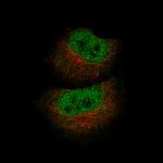 MBP Monoclonal Antibody (CL2819)