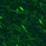 MBP Antibody in Immunohistochemistry (Paraffin) (IHC (P))