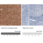 VGLUT2 Monoclonal Antibody (CL2952)