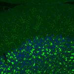 VGLUT2 Antibody in Immunohistochemistry (Paraffin) (IHC (P))