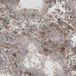 Laminin beta-1 Antibody in Immunohistochemistry (Paraffin) (IHC (P))