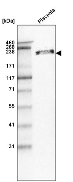 Laminin beta-1 Antibody in Western Blot (WB)